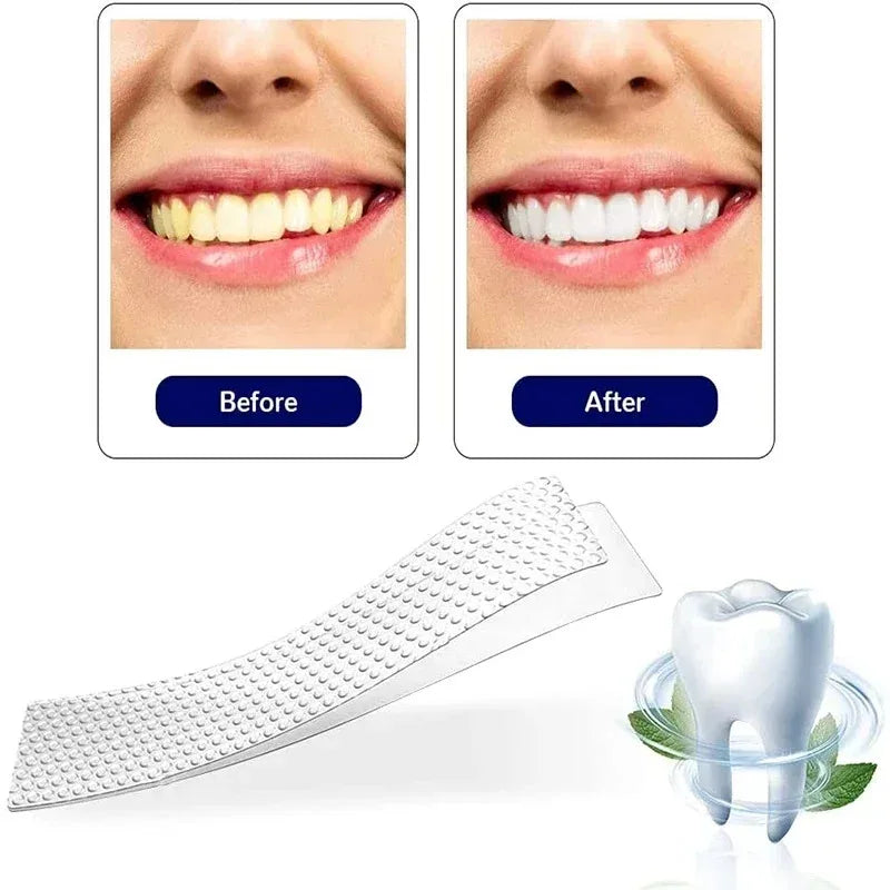 Clareador de Dentes 5D